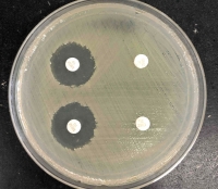 薬剤感受性試験